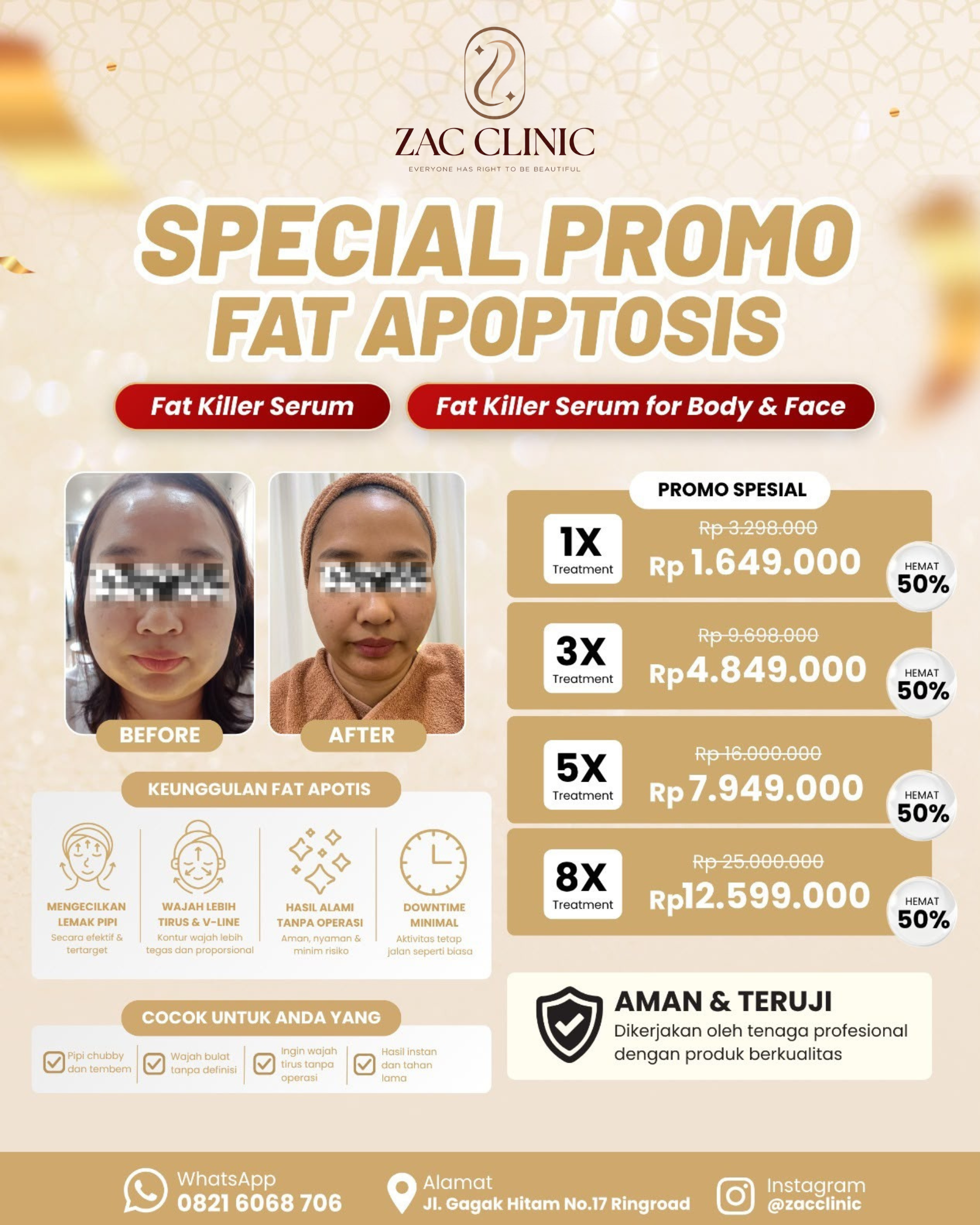 Special Promo Fat Apoptosis