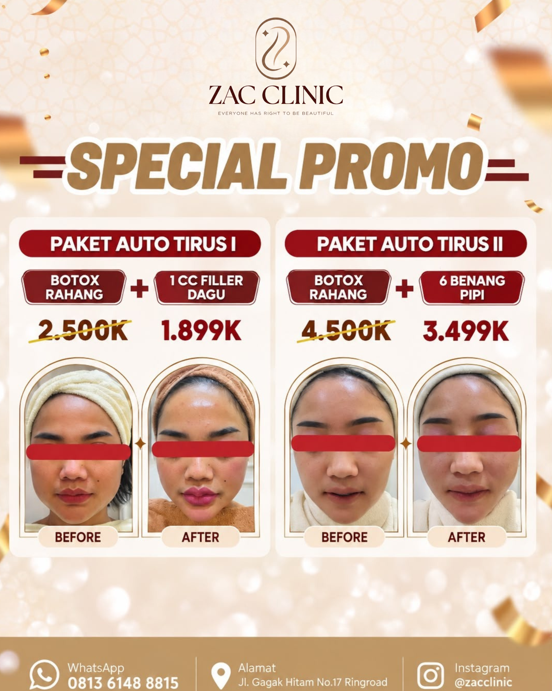 Special Promo Paket Auto Tirus