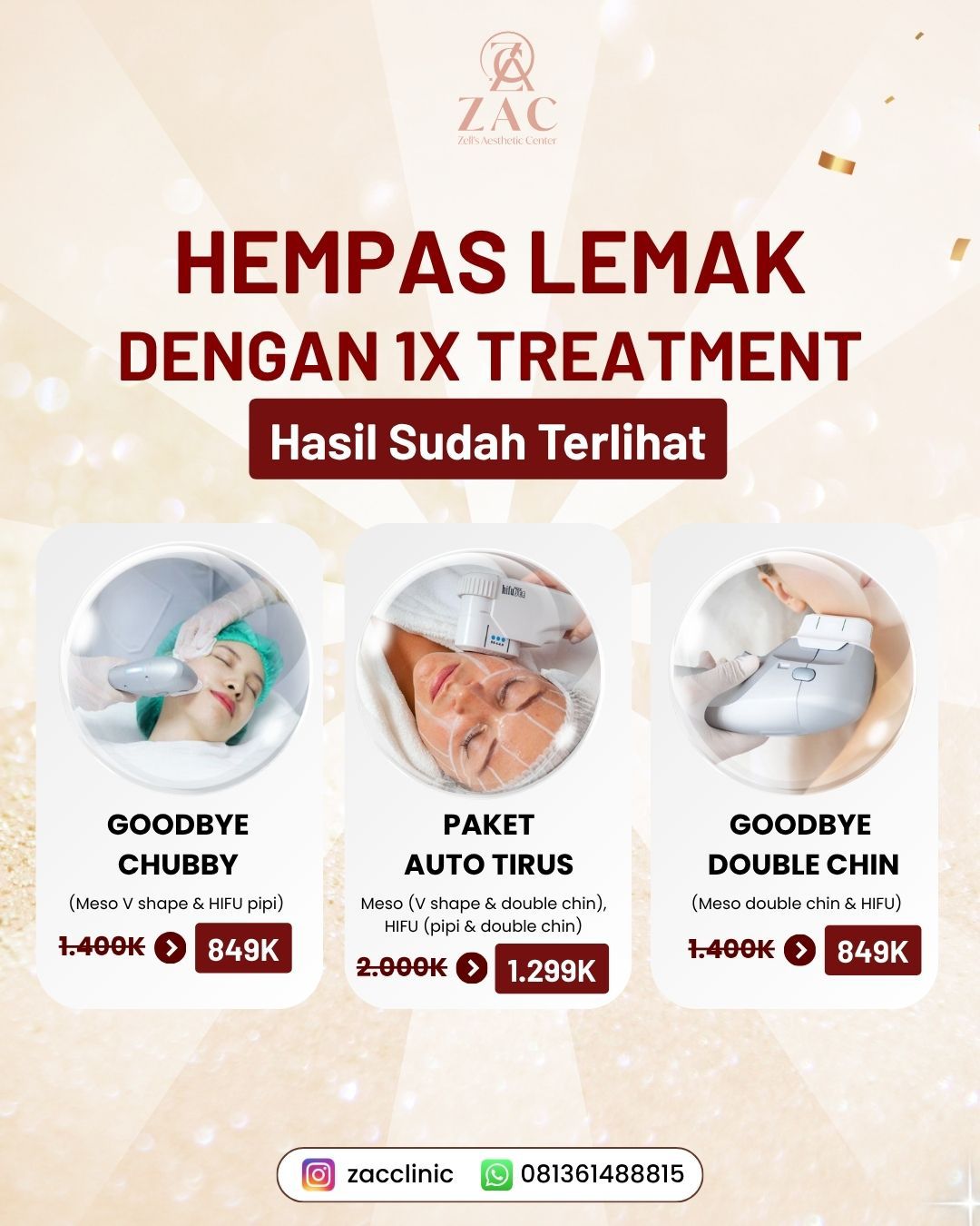 Hempaskan Lemak-Meso Hifu